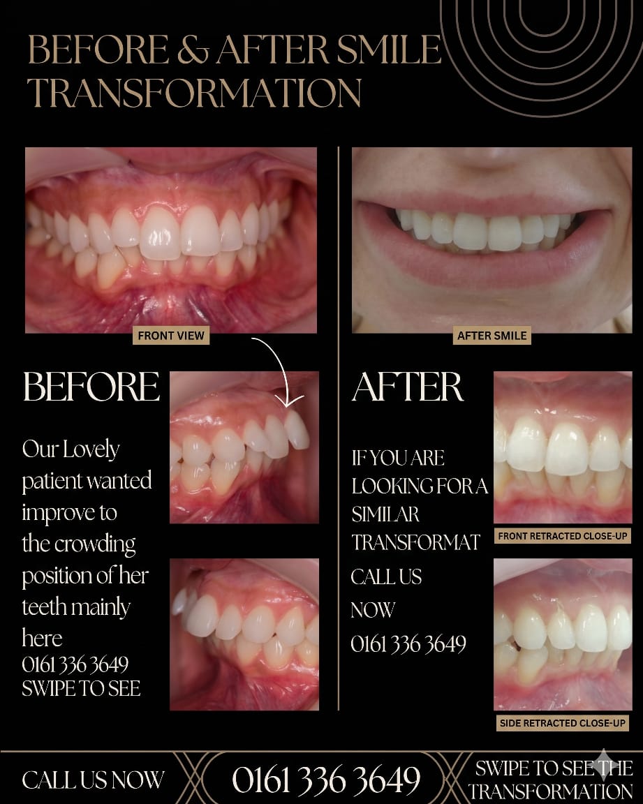 Clear Aligners Manchester